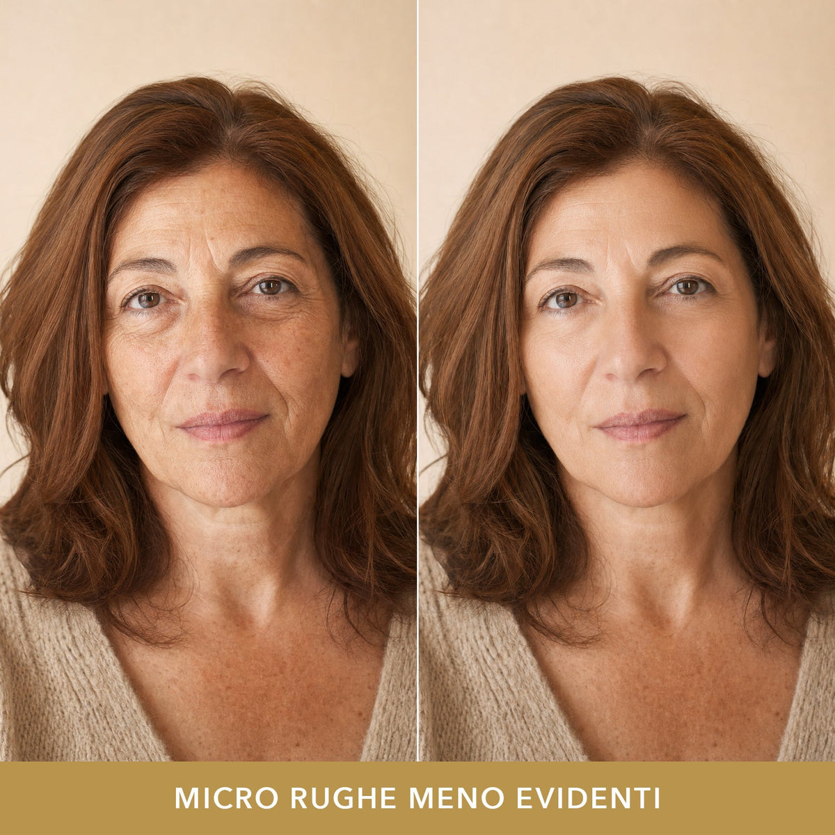Micro rughe meno evidenti: prima e dopo