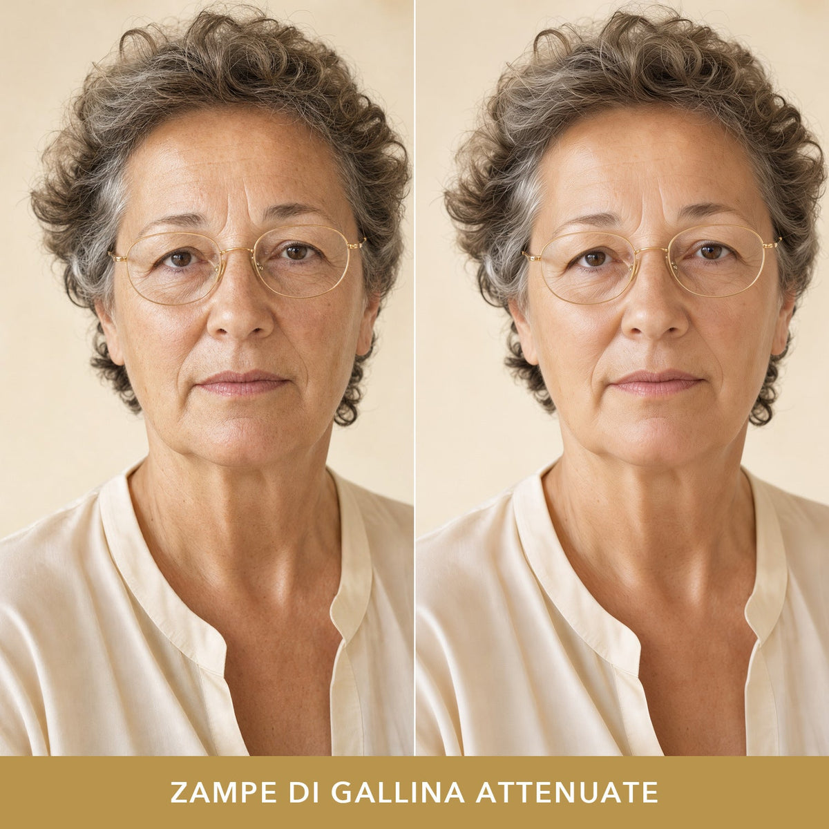 Zampe di gallina attenuate: prima e dopo